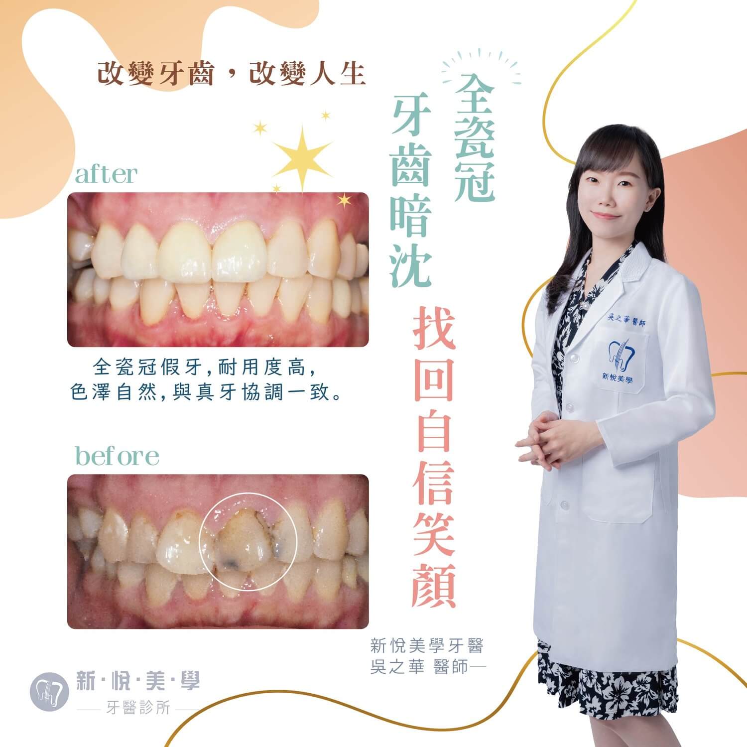 新悅美學牙醫診所的案例分享圖片